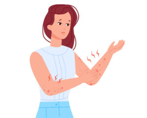 Irritação na Pele.